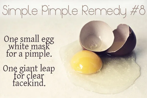 Spot treatments are the best choice for small acne breakouts